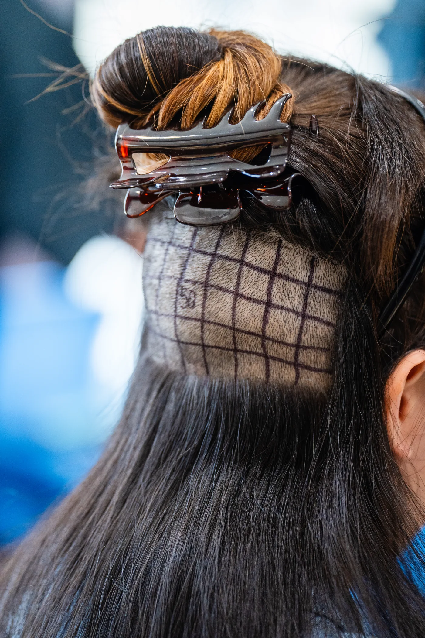 Elite Hair Clinic 11